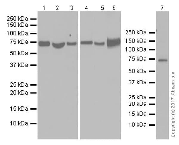 Optineurin Antibody Epr20654 Ab213556  Western Blot Img41246