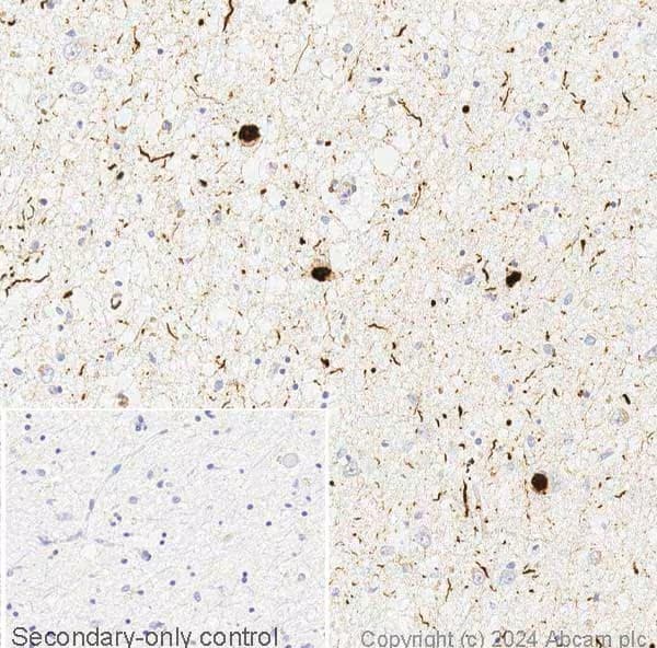 Anti-Alpha-synuclein (phospho S129) antibody [MJF-R13 (8-8)](AB168381)