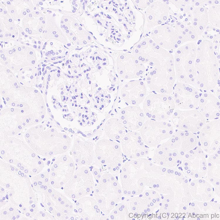 Anti-IL-1RA antibody [EPR26853-58](AB303490)