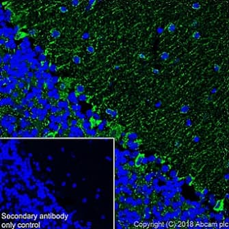 Abat Gaba T Antibody Epr20842 Bsa And Azide Free Ab233702  Immunohistochemistry Frozen Sections Img3355