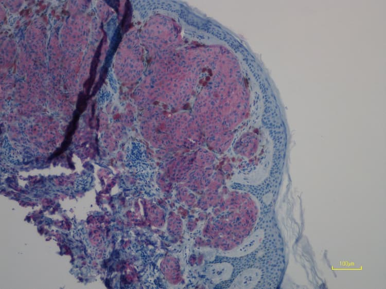 Anti-Ras (mutated Q61R) antibody [SP174](AB227658)