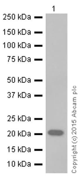 Rbp4 Antibody Ep3657 Ab109193  Western Blot Img83279