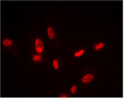 Human SIRT1 ELISA Kit(AB171573)