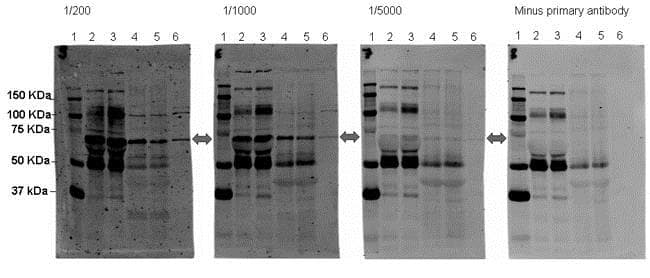 Sorbs1 Antibody Ab4551  Western Blot Img106450