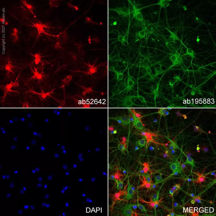 Anti-S100 beta antibody [EP1576Y] - Astrocyte Marker(AB52642)