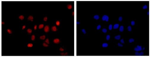 Nhp2l1 Antibody Epr11671 Ab181982  Immunocytochemistry Immunofluorescence Img93617