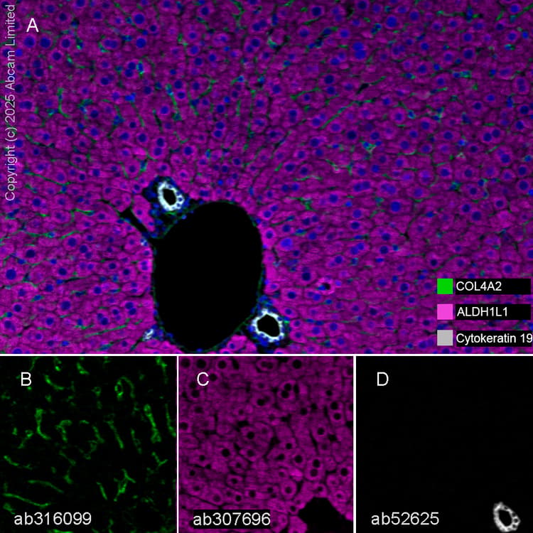 Aldh1l1 Antibody Epr25443 103 Astrocyte Marker Ab307696  Multiplex Immunohistochemistry Img447125
