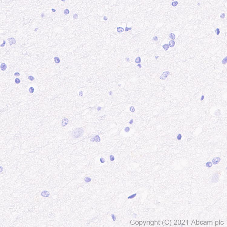 Anti-IL2 Receptor beta/p75 antibody [EPR24336-29](AB271040)