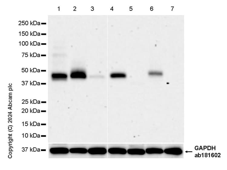 Pai1 Antibody Epr21850 262 Bsa And Azide Free Ab317605  Western Blot Img431717
