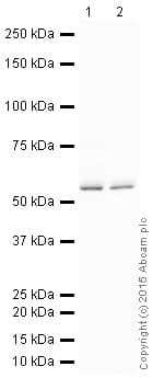 HRP Anti-GBA antibody [EPR5142](AB200856)