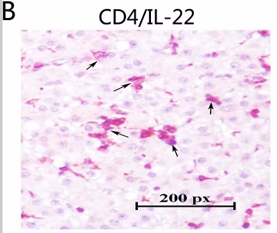 Rabbit Mouse Igg H L Hrp Ab6728 Immunohistochemistry Formalin Pfa Fixed Paraffin Embedded Sections Img102448