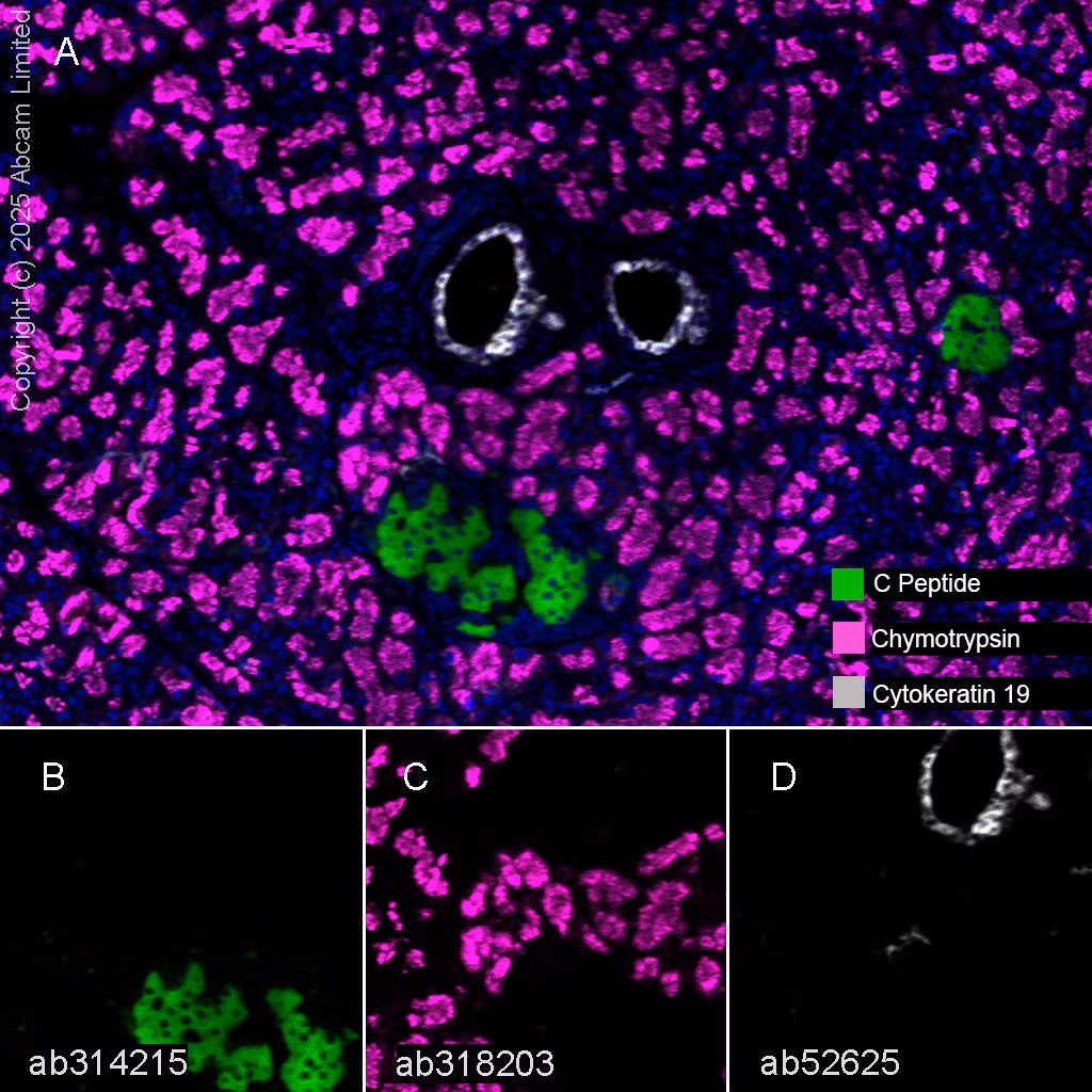 Cytokeratin 19 Antibody Ep1580y Cytoskeleton Marker Ab52625 Multiplex Immunohistochemistry Img447480