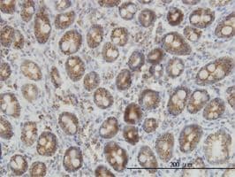 Idh2 Antibody 5f11 Ab55271  Immunohistochemistry Formalin Pfa Fixed Paraffin Embedded Sections Img78538