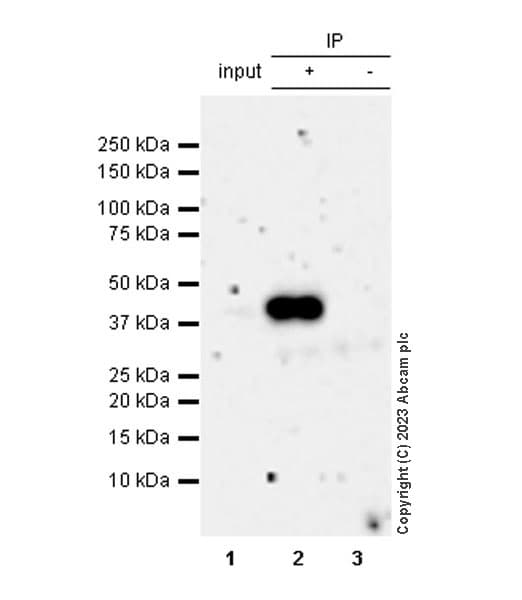 Anti-Mycobacterium tuberculosis Ag85B antibody [EPR28401-54] - BSA and Azide free(AB312329)