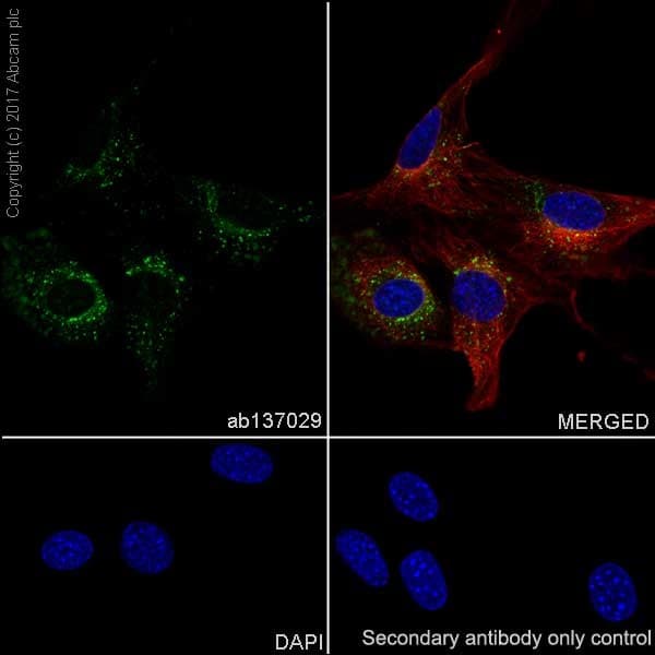 Anti-RAB7 antibody [EPR7589](AB137029)