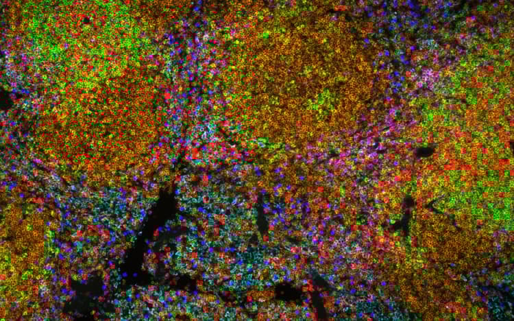 Multiplex IHC Detection kit (TSA amplification)(AB312827)