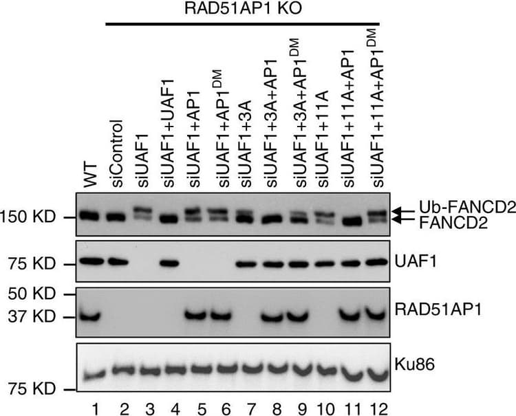 Rad51ap1 Antibody Ab88370  Western Blot Img443382
