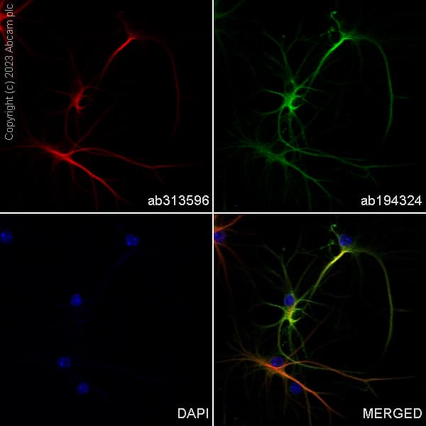 Alexa Fluor® 488 Anti-GFAP antibody [EPR1034Y](AB194324)