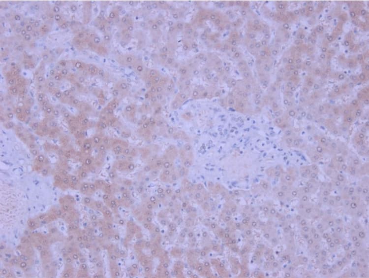 Anti-IGF1+IGF2 antibody(ab9572)