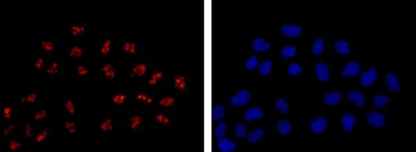 Ddx21 Antibody Epr14495 Ab182156  Immunocytochemistry Immunofluorescence Img15424