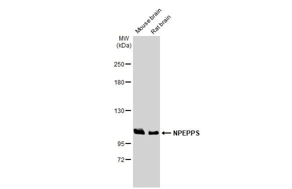 Npepps Antibody Hl1531 Ab308163  Western Blot Img407063