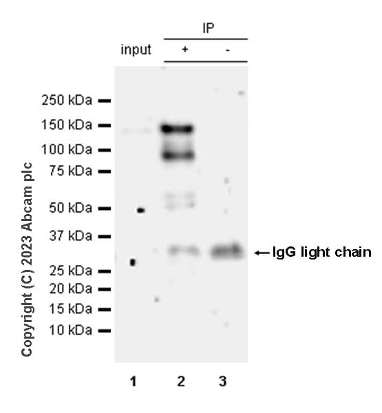 Mda5 Antibody Epr28350 21 Ab315242  Immunoprecipitation Img424447