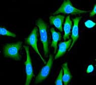 Calpain 1 Antibody Epr3319 Ab108400  Immunocytochemistry Immunofluorescence Img34441