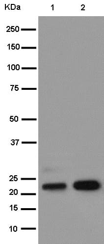 Anti-Bok antibody [EPR15331](AB186745)