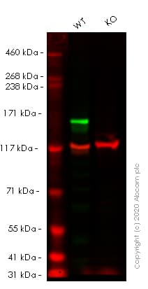 Anti-MSH6 antibody [EPR3945](AB92471)