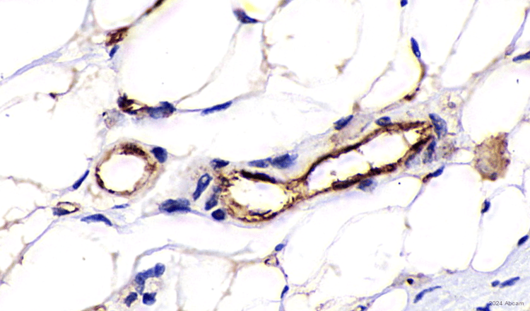 Anti-CD31 antibody [RM1006](AB281583)