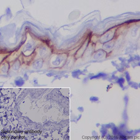 Trop2 Antibody Epr20043 Ab214488 Immunohistochemistry Formalin Pfa Fixed Paraffin Embedded Sections Img405213