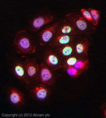 Anti-acetyl Lysine antibody [1C6](AB22550)