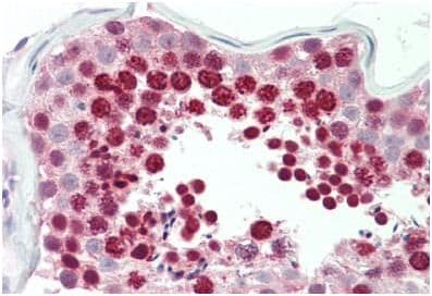 Hoxa10 Antibody Ab191470  Immunohistochemistry Formalin Pfa Fixed Paraffin Embedded Sections Img43653