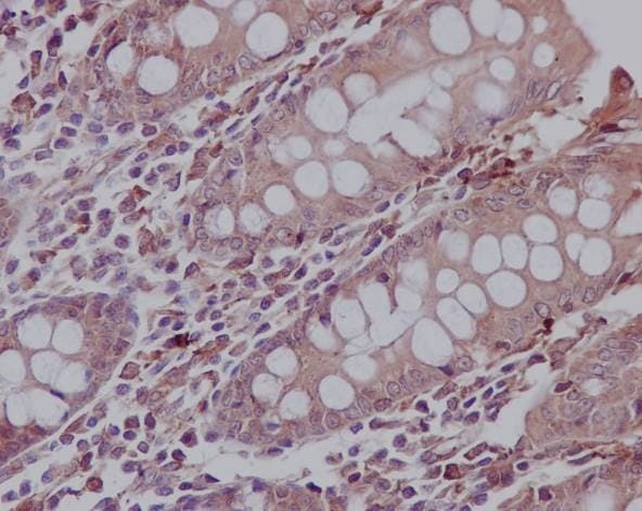 Fibroblast Marker (Vimentin, alpha smooth muscle Actin, Hsp47, S100A4) Antibody Panel - Human, Mouse(AB254015)