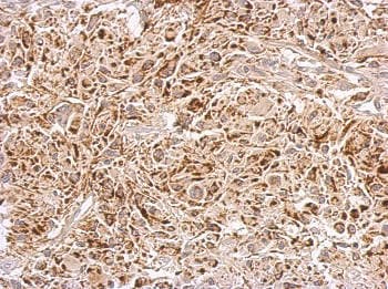 Abat Gaba T Antibody Ab152134  Immunohistochemistry Formalin Pfa Fixed Paraffin Embedded Sections Img120662