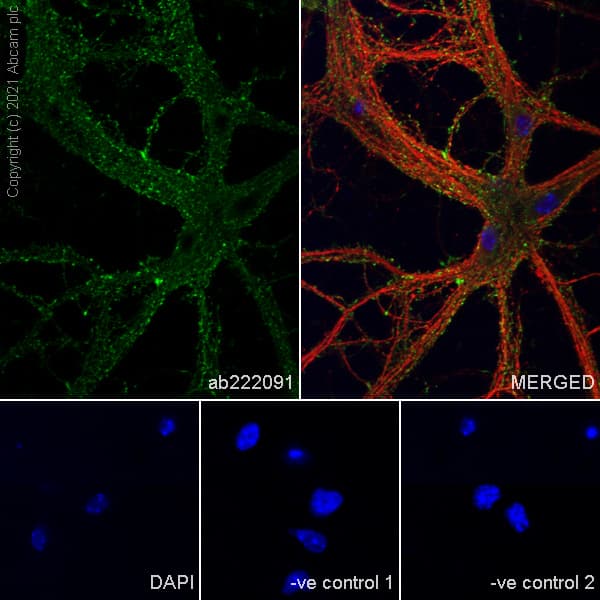 Scn1a Antibody Epr22326 112 Ab222091  Immunocytochemistry Immunofluorescence Img72673