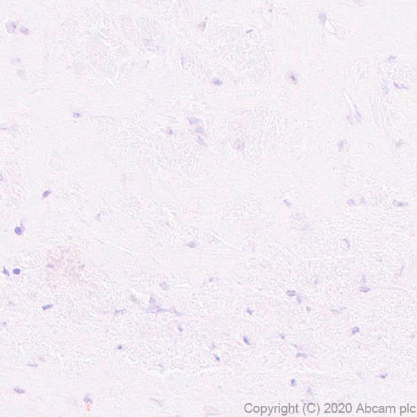 Anti-Pit1 antibody [EPR23555-203](AB273048)