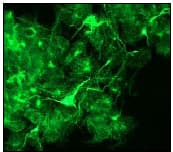 Alpha Internexin Antibody Ep676y Ab40758  Immunocytochemistry Immunofluorescence Img93630
