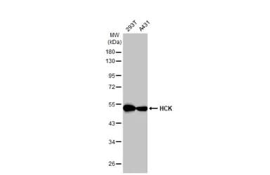 Hck Antibody Hl1673 Ab308234  Western Blot Img407222