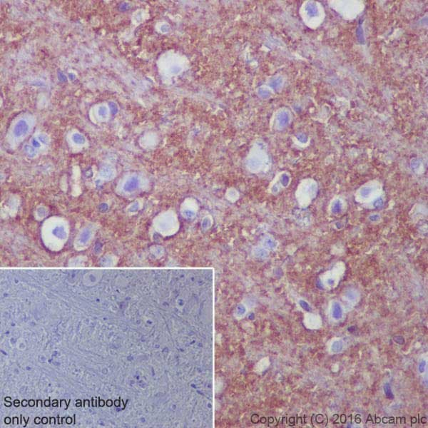 Anti-EAAT2 antibody [EPR19798] - BSA and Azide free(AB271970)
