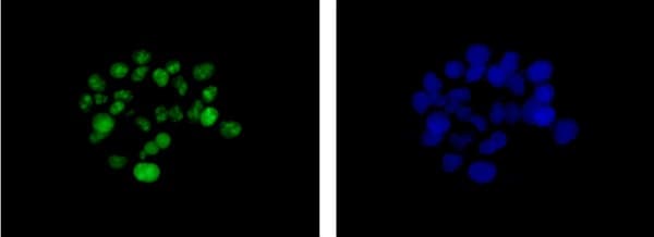 Ddx21 Antibody Epr14495 Ab182156  Immunocytochemistry Immunofluorescence Img14462