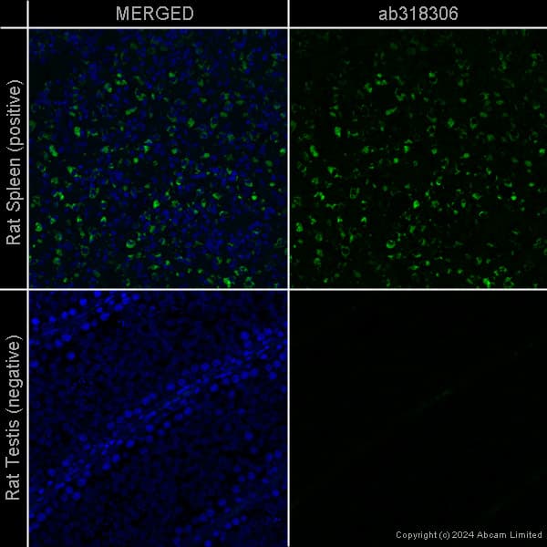 Anti-CD68 antibody [EPR23917-164] – Chicken IgY (Chimeric)(AB318303)