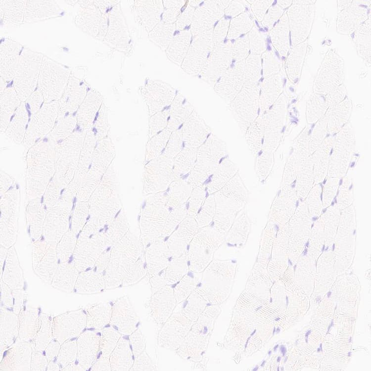 Anti-MYBPC3 antibody [EPR25673-58](AB308619)