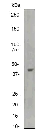 Anti-ACTC1 antibody [EP184E](AB46805)