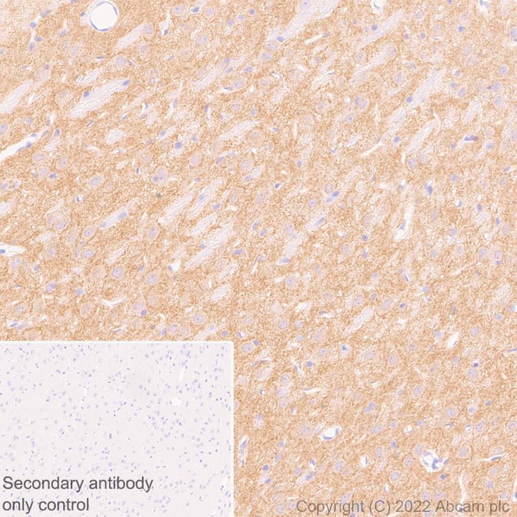 Anti-GABRD antibody [EPR25324-253](AB300348)