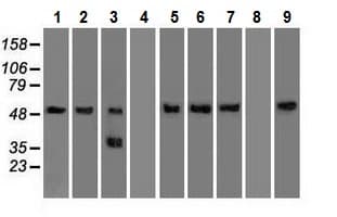 Anti-alpha 1 Antitrypsin antibody [11G2](AB230695)
