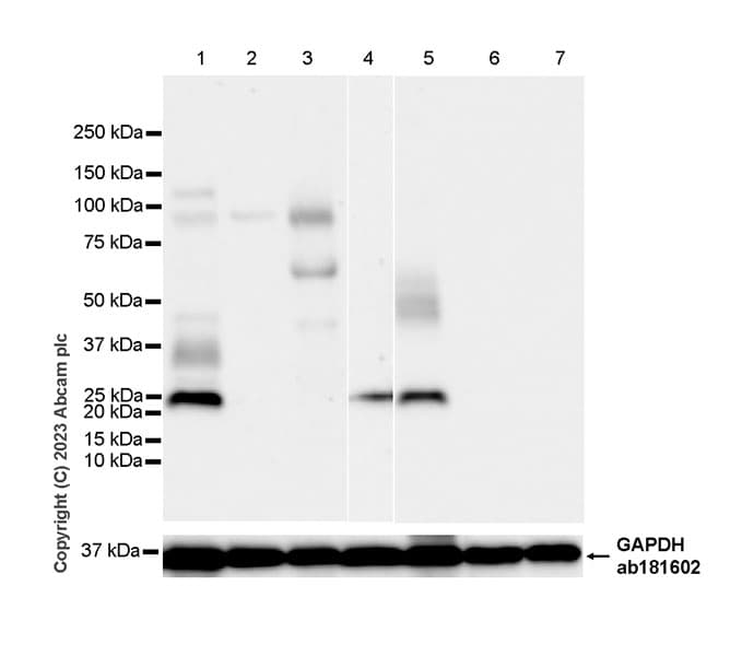 Anti-RS1 antibody [EPR28513-78](AB314231)