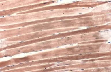 Anti-Sarcomeric Alpha Actinin antibody(AB137346)