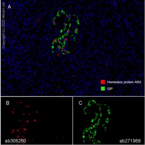 Arx Antibody Epr27481 32 Ab308260  Multiplex Immunohistochemistry Img408980