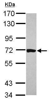 Hcc1 Antibody Ab229238  Western Blot Img160166